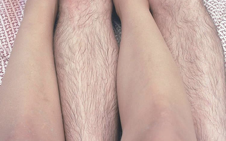 フォト2:アニュ a nu(烏丸御池/脱毛サロン)の画像