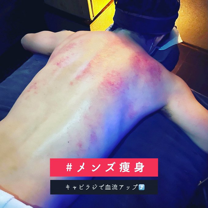 メンズ痩身(キャビテーション):Kelopak Bunga クロパブンガ(天神橋筋六丁目/リラクゼーション・脱毛)の画像