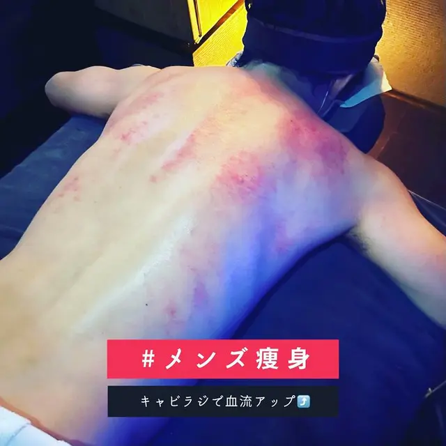 メンズ痩身(キャビテーション):Kelopak Bunga クロパブンガ(天神橋筋六丁目/リラクゼーション・脱毛)のフォト(写真)